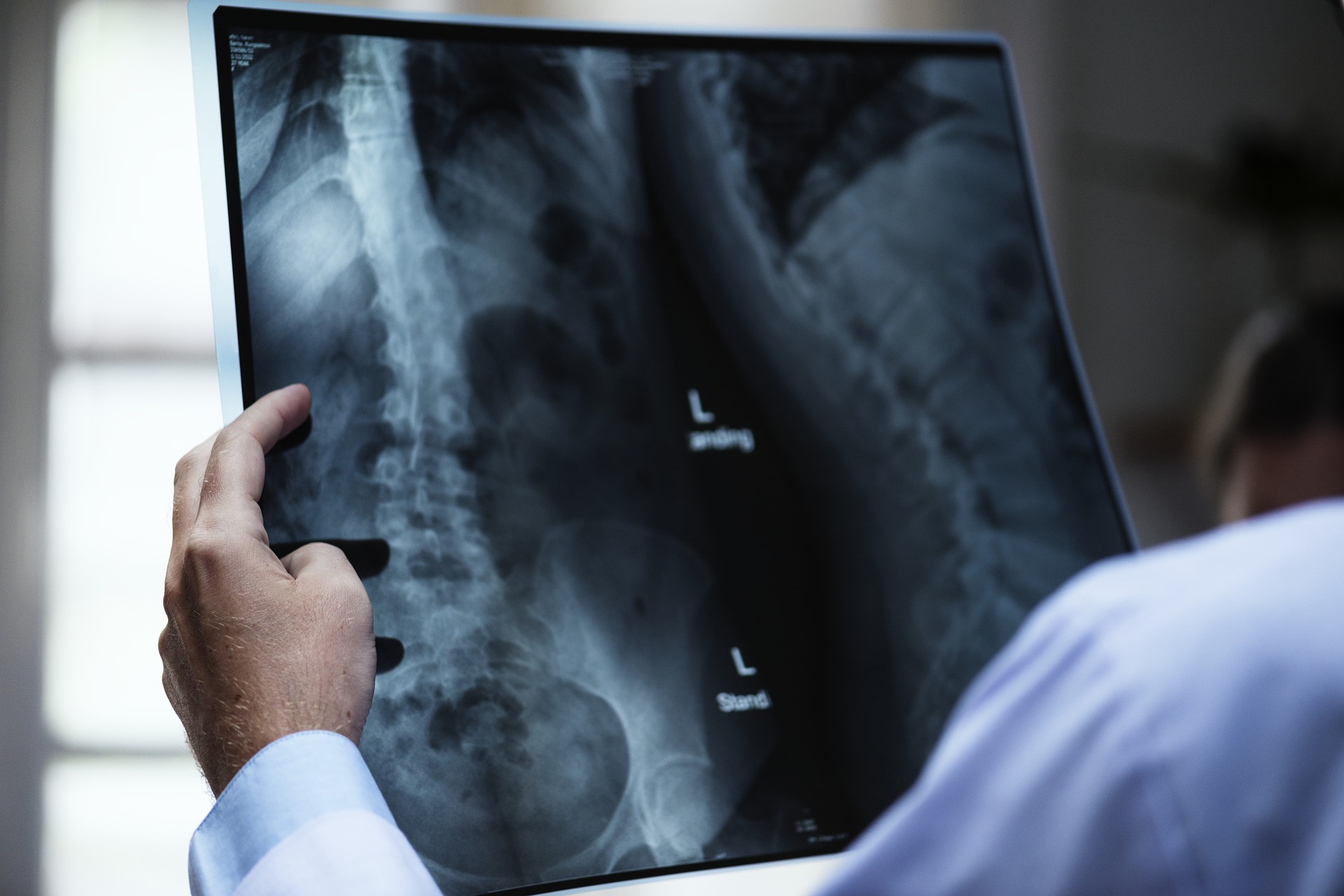 Doctor Examining X-Ray of Spine