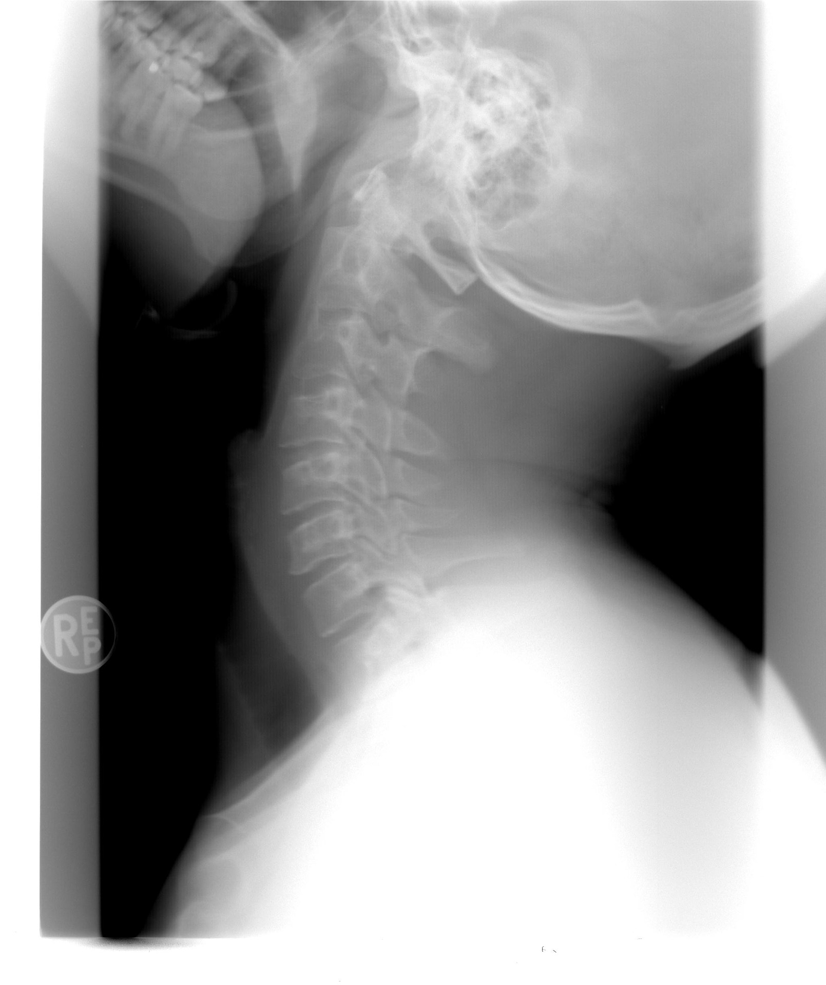 Neck X-Ray